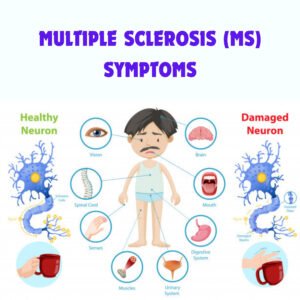 MULTIPLE SCLEROSIS (MS)