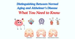 Distinguishing Between Normal Aging and Alzheimer’s Disease: What You Need to Know"