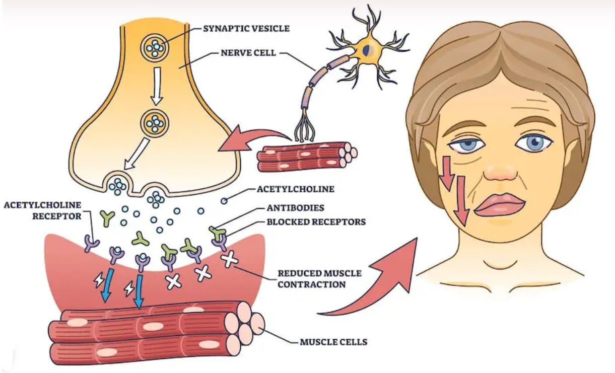 l-carnitine and elevated liver enzymes L-Carnitine | Linus Pauling Institute